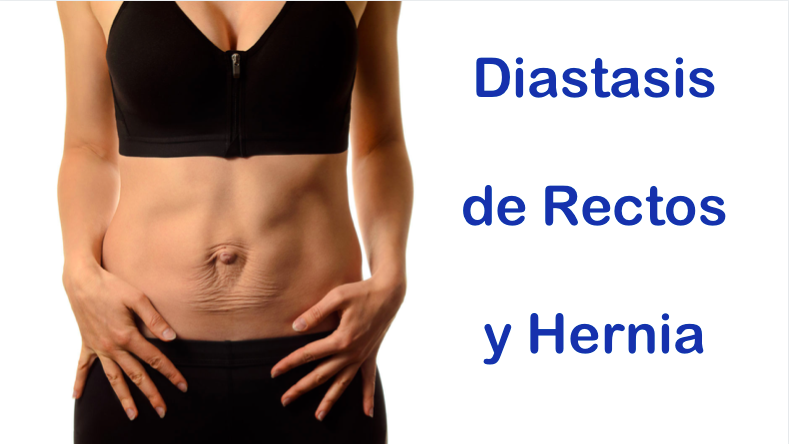 diástasis de rectos y hernia doctor especialista