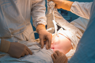 como-se-ve-una-hernia-inguinal imagen hernia inguinal
